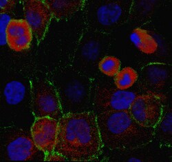 MilliporeSigma Mouse anti-PAFAH 1B3, Clone: 3E4.1, 100&mu;g:Antibodies,
